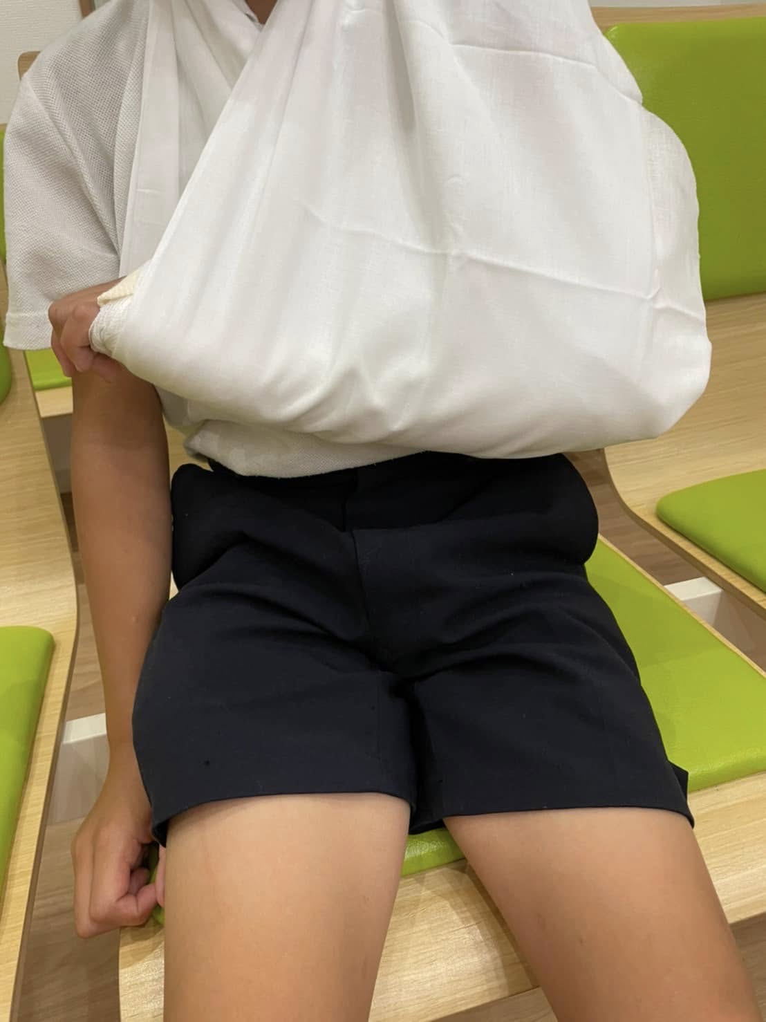 外顆骨折の画像（一例）