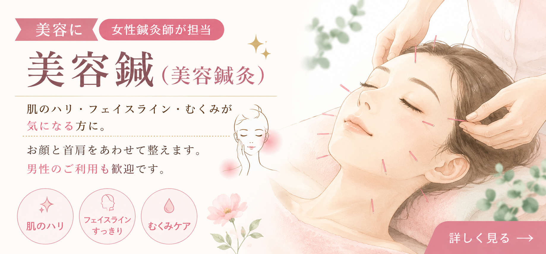 美容鍼(美容鍼灸)