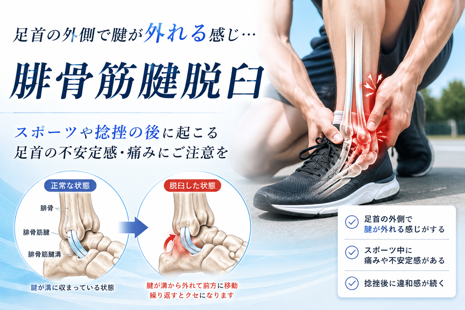 腓骨筋腱脱臼・外くるぶし後方の痛み・捻挫と間違われやすいケガの解説イメージ