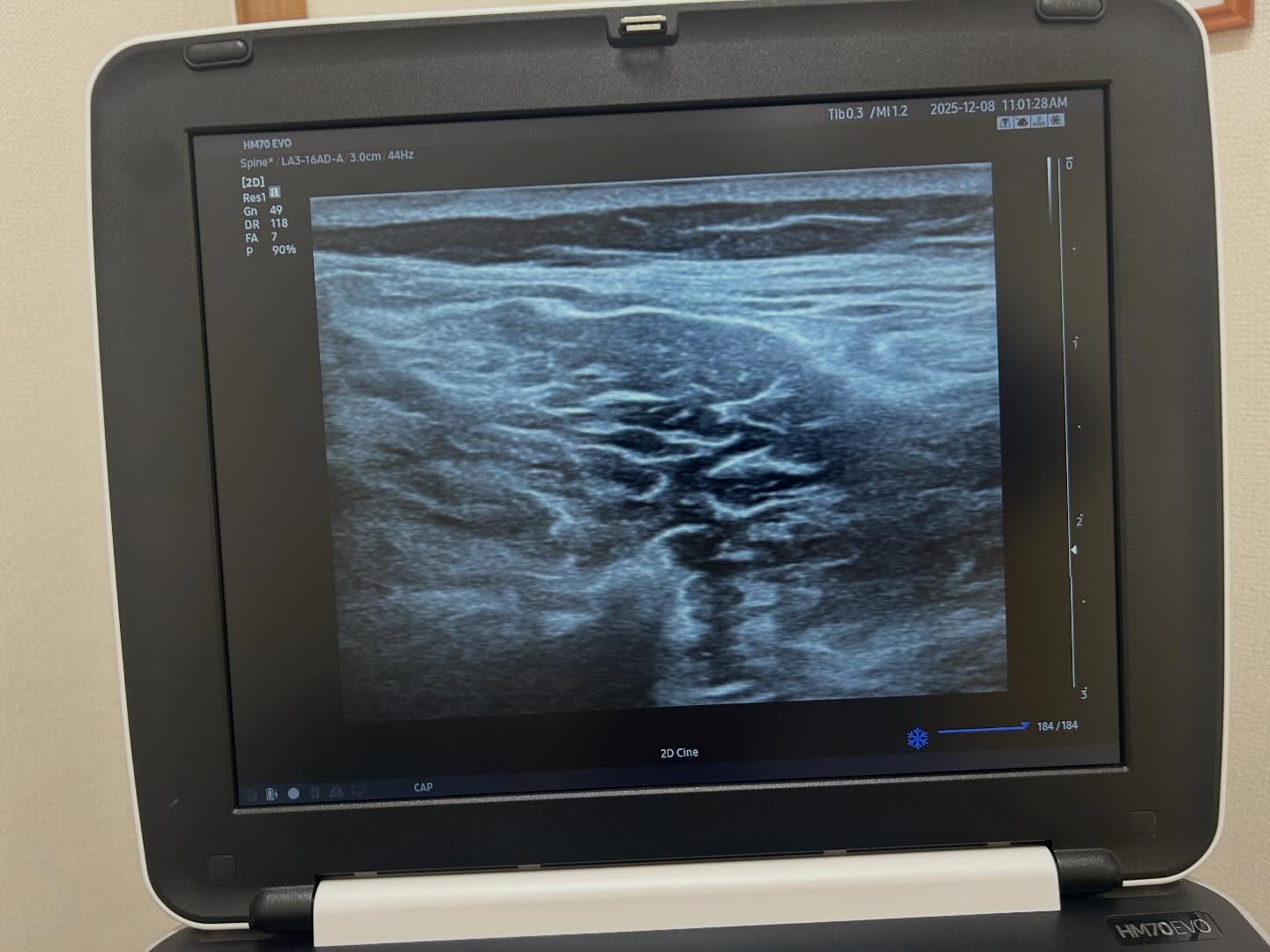 下関のみよし鍼灸整骨院で撮影した写真