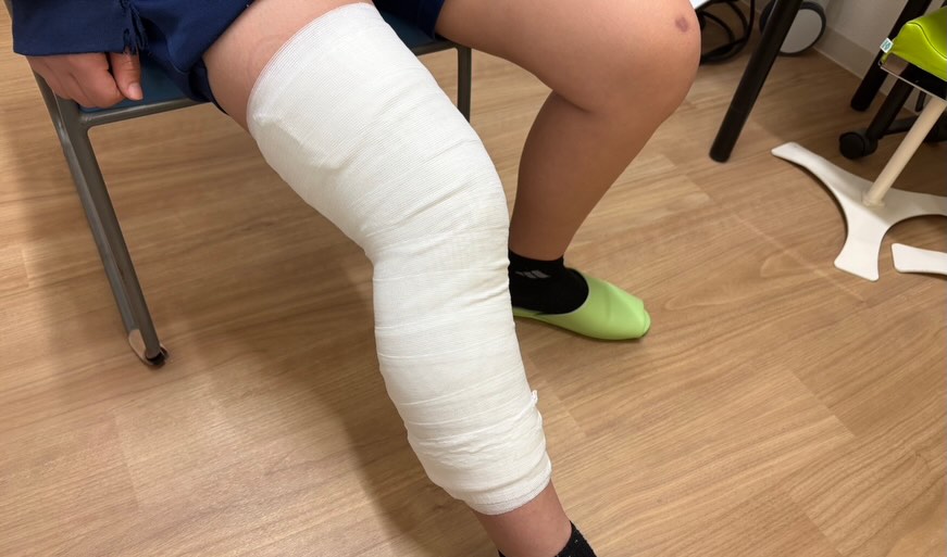 みよし鍼灸整骨院の固定